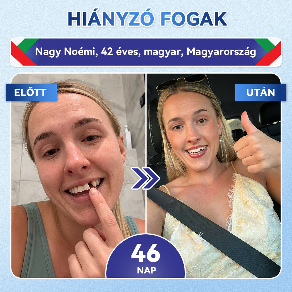 🦷🦷𝐆𝐥𝐢𝐦𝐦𝐞𝐫𝐥𝐲® Tideglusib Fog & íny Javító mikrotűs tapasz | Fejlett őssejt-aktiváló fogcsíkok (újjáépíti a fogzománcot és a dentint • erősíti az ínyt • megszünteti a fogkövet és a szagokat • megállítja a fogérzékenységet)) 3.0