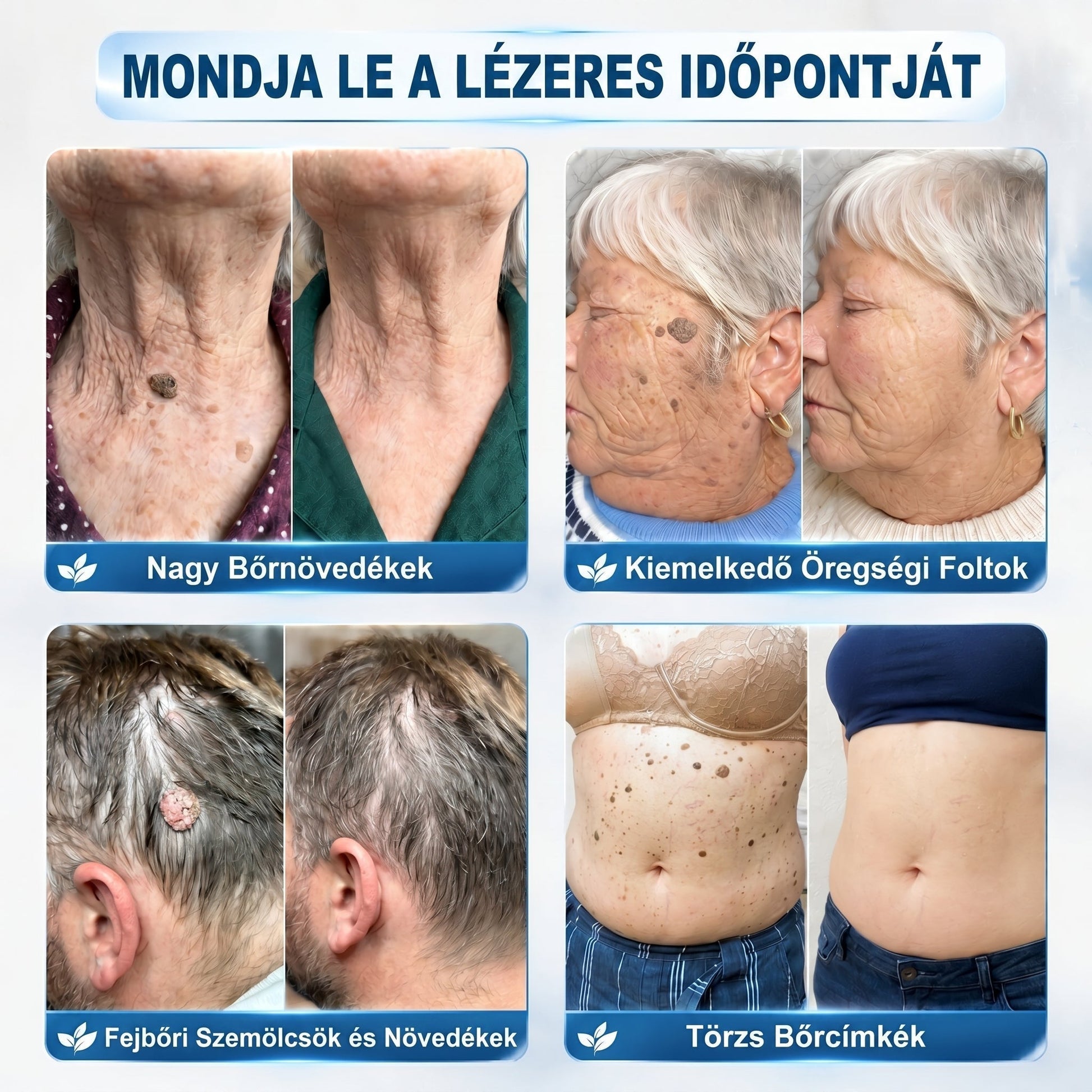 Healrize® Bőrhibák Ápoló Roll-On Egyszerű otthoni használat🎁