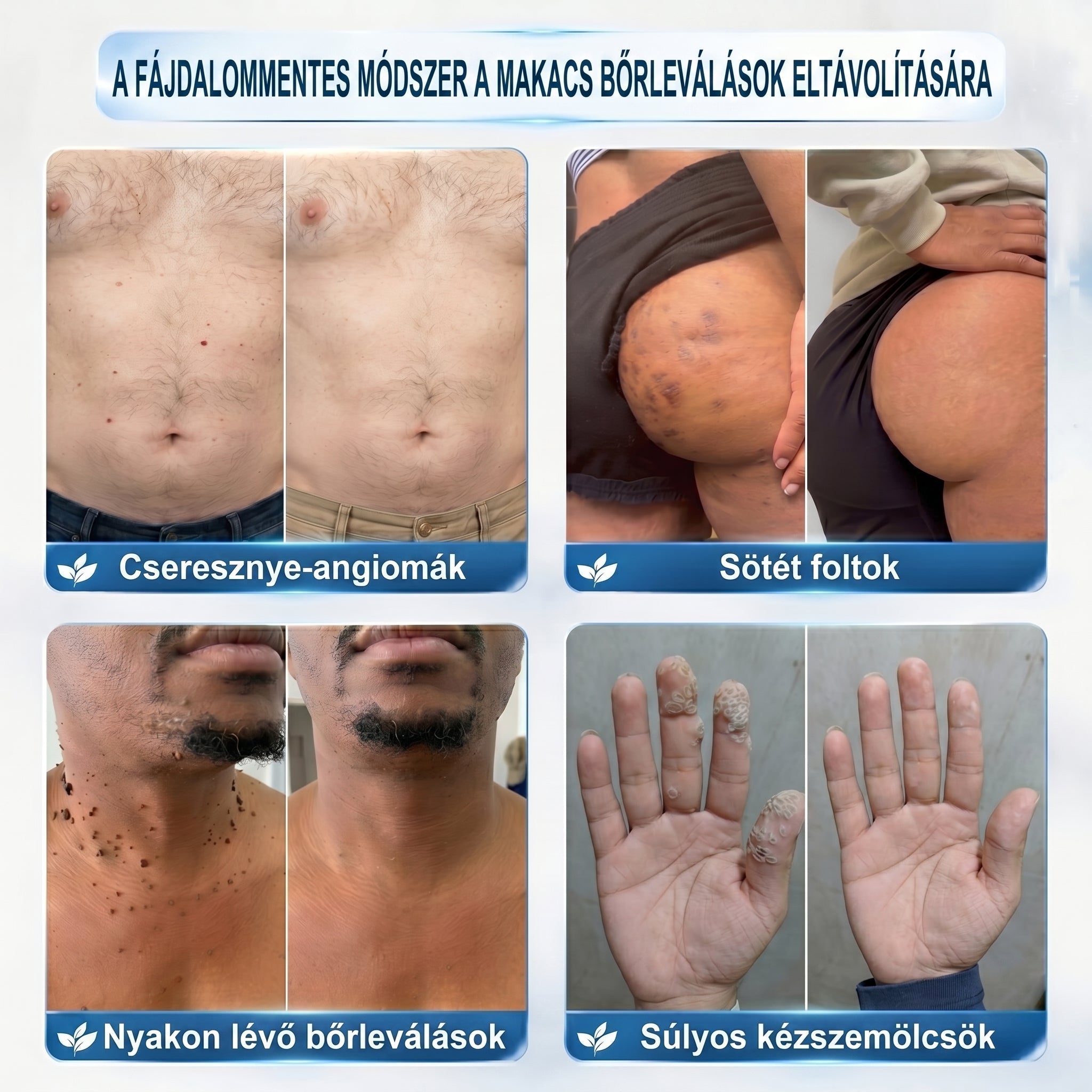Healrize® Bőrhibák Ápoló Roll-On Egyszerű otthoni használat🎁