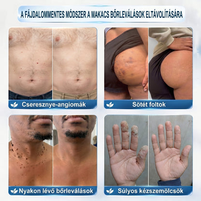 Healrize® Bőrhibák Ápoló Roll-On Egyszerű otthoni használat🎁