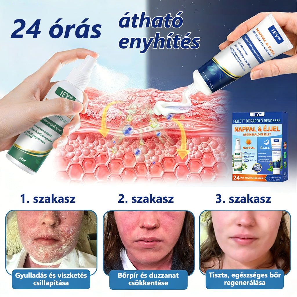 𝑰𝑬𝒀® 👩‍⚕️𝑷𝒔𝒐𝒓𝒊𝒂𝒔𝒊𝒔 𝒏𝒂𝒑𝒑𝒂𝒍𝒊 é𝒔 é𝒋𝒔𝒛𝒂𝒌𝒂𝒊 𝒉𝒆𝒍𝒚𝒓𝒆á𝒍𝒍í𝒕ó 𝒓𝒆𝒏𝒅𝒔𝒛𝒆𝒓 - 100% 𝒔𝒛𝒕𝒆𝒓𝒐𝒊𝒅𝒎𝒆𝒏𝒕𝒆𝒔 𝒅𝒖ó 𝒂 𝒑𝒍𝒂𝒌𝒌𝒐𝒌, 𝒉á𝒎𝒍á𝒔 é𝒔 𝒗𝒊𝒔𝒛𝒌𝒆𝒕é𝒔 𝒆𝒏𝒚𝒉í𝒕é𝒔é𝒓𝒆 (𝒂𝒋á𝒏𝒍𝒂𝒕)