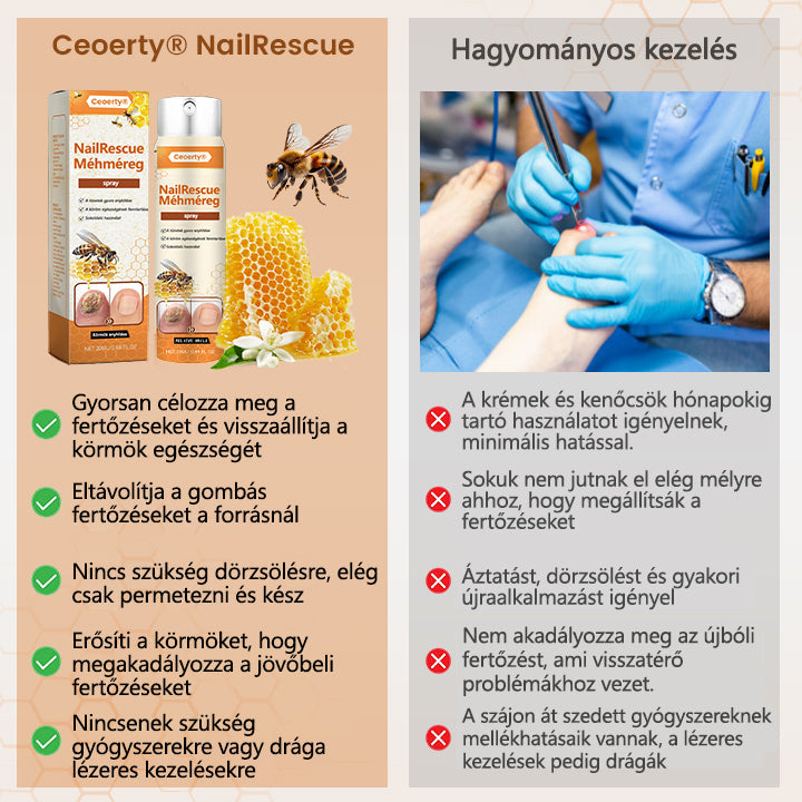 2026🎁 Korlátozott idejű akció 70% kedvezménnyel ️️⏳ Ceoerty® körömgomba spray méhméreggel 💥 2 hét alatt megoldja az összes körömproblémát