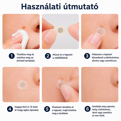 🎉🇭🇺 Healrize® 2 az 1-ben mikrotűs + hidrokolloid tapasz 🤩| Anyajegy, pattanás, lapos szemölcs és bőrkinövés ápolására | Ráncok, hegek és bőrhibák megjelenésének javítására | Láthatatlan tapasz arcra és testre⭐️