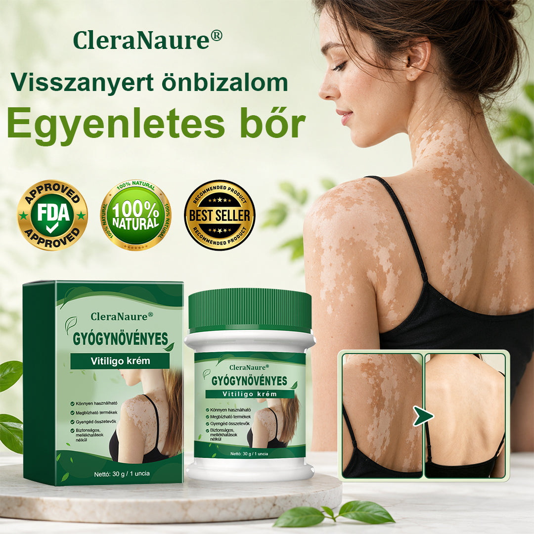 💎CleraNaure® Növényi Vitiligo Krém