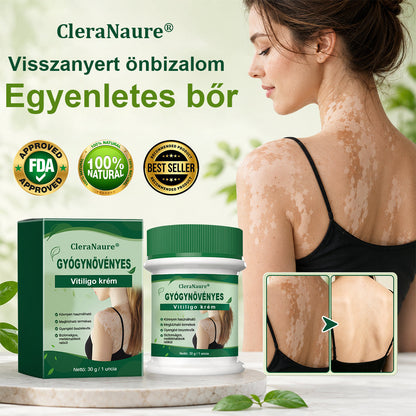 💎CleraNaure® Növényi Vitiligo Krém