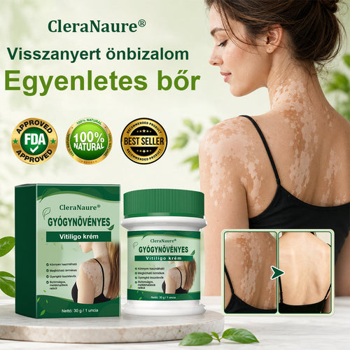 💎CleraNaure® Növényi Vitiligo Krém