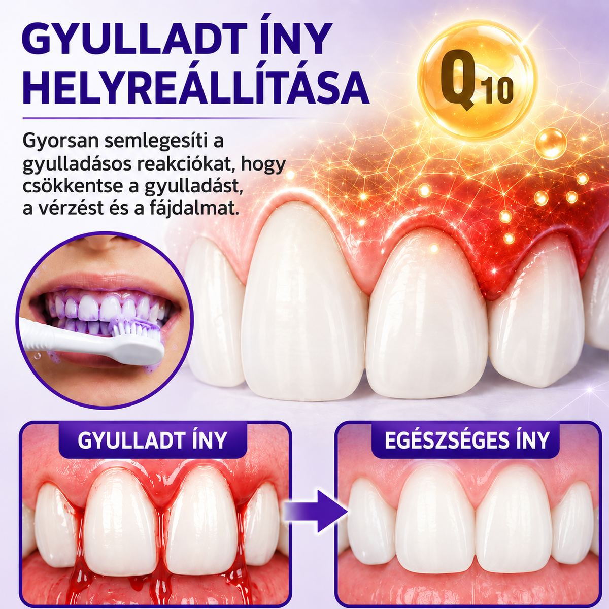 Ceoerty® ínygyulladás és fogágybetegségek kezelésére szolgáló fogkrém🎁