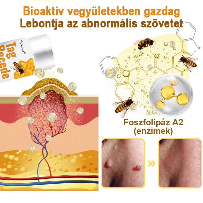 🐝🐝Méhméreg szemölcs és övsömör eltávolító spray (👨‍⚕AAD Ajánlott) 🔥(🔥Last Day 80% Off)