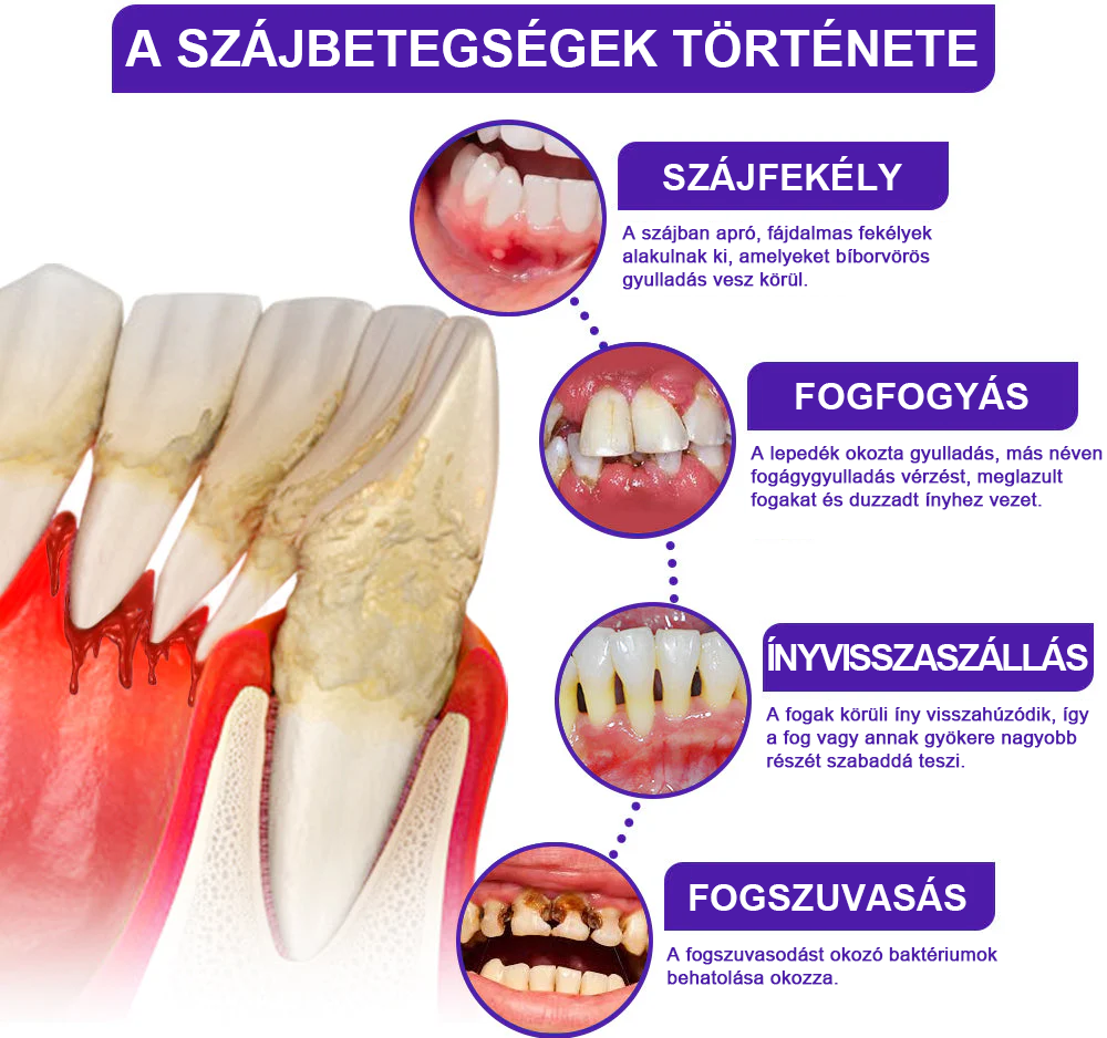 🌟Rolimey® VioCore Méhméreg Fogkezelő Fogkrém🩹
