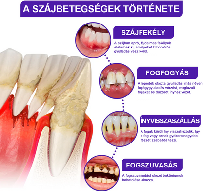 🌟Rolimey® VioCore Méhméreg Fogkezelő Fogkrém🎁