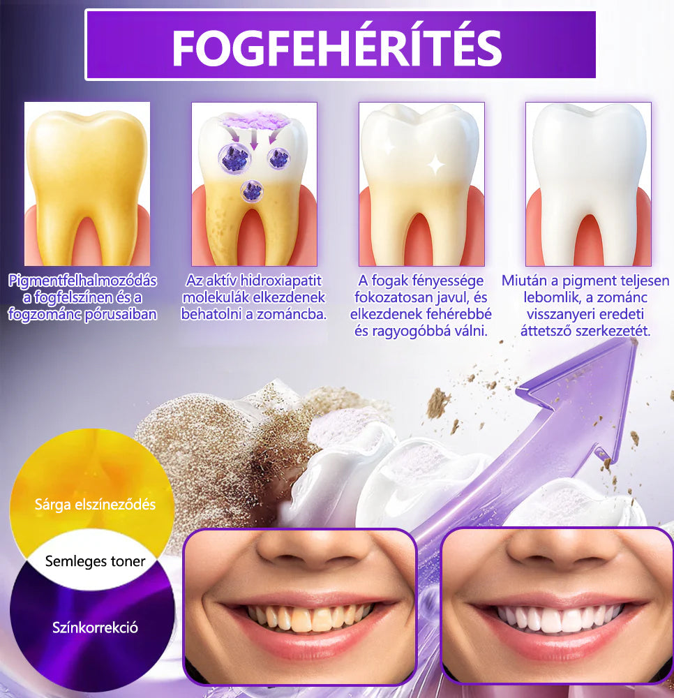 𝐷𝑜𝒓𝒎𝒐𝒓𝑛𝑎® Fogregeneráló és -javító por hidroxiapatittal 🦷 (hatékonyan javítja a fogszuvasodást, az ínyproblémákat, a fogak túlérzékenységét, a szájfekélyeket és a fogak sárgulását, átfogóan javítva a szájhigiéniát) 🍀