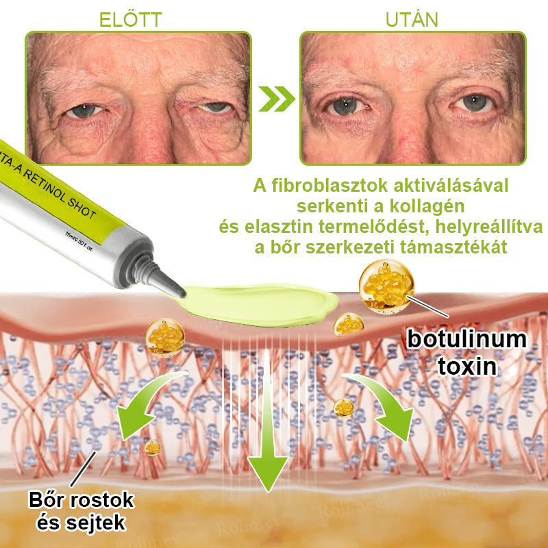 ✨ Vosxu™ Botox & Vita-A Retinol Shot ráncfelvarró szérum ✨ – 💉 Mikro-tűk | 💪 Botox-szerű peptidek | 🌿 Retinol | ⚡ Látható eredmények már 3 nap alatt 🌸