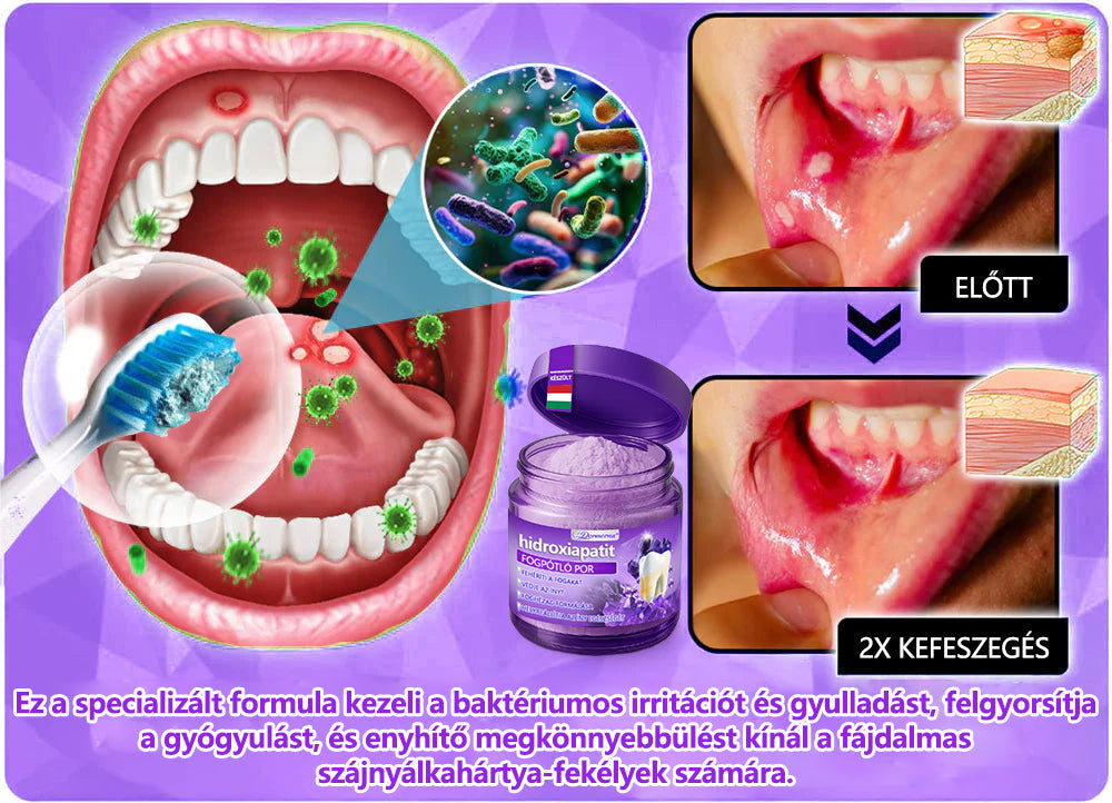 𝐷𝑜𝒓𝒎𝒐𝒓𝑛𝑎® Fogregeneráló és -javító por hidroxiapatittal 🦷 (hatékonyan javítja a fogszuvasodást, az ínyproblémákat, a fogak túlérzékenységét, a szájfekélyeket és a fogak sárgulását, átfogóan javítva a szájhigiéniát) 🍀