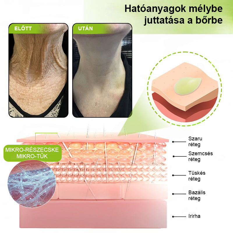 ✨ Vosxu™ Botox & Vita-A Retinol Shot ráncfelvarró szérum ✨ – 💉 Mikro-tűk | 💪 Botox-szerű peptidek | 🌿 Retinol | ⚡ Látható eredmények már 3 nap alatt 🌸