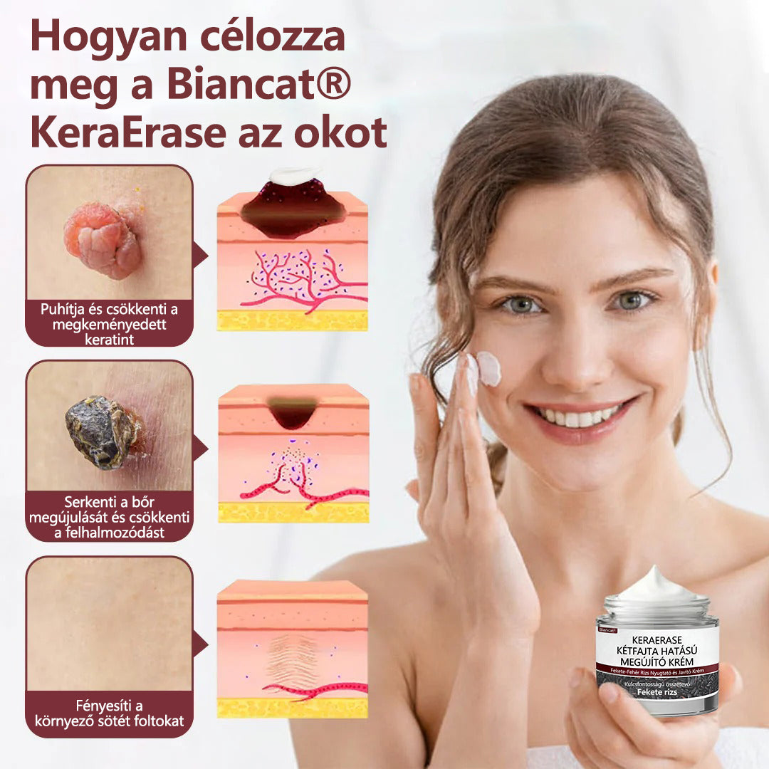 🔥🔥Broxie® KeraErase kettős hatású megújító krém