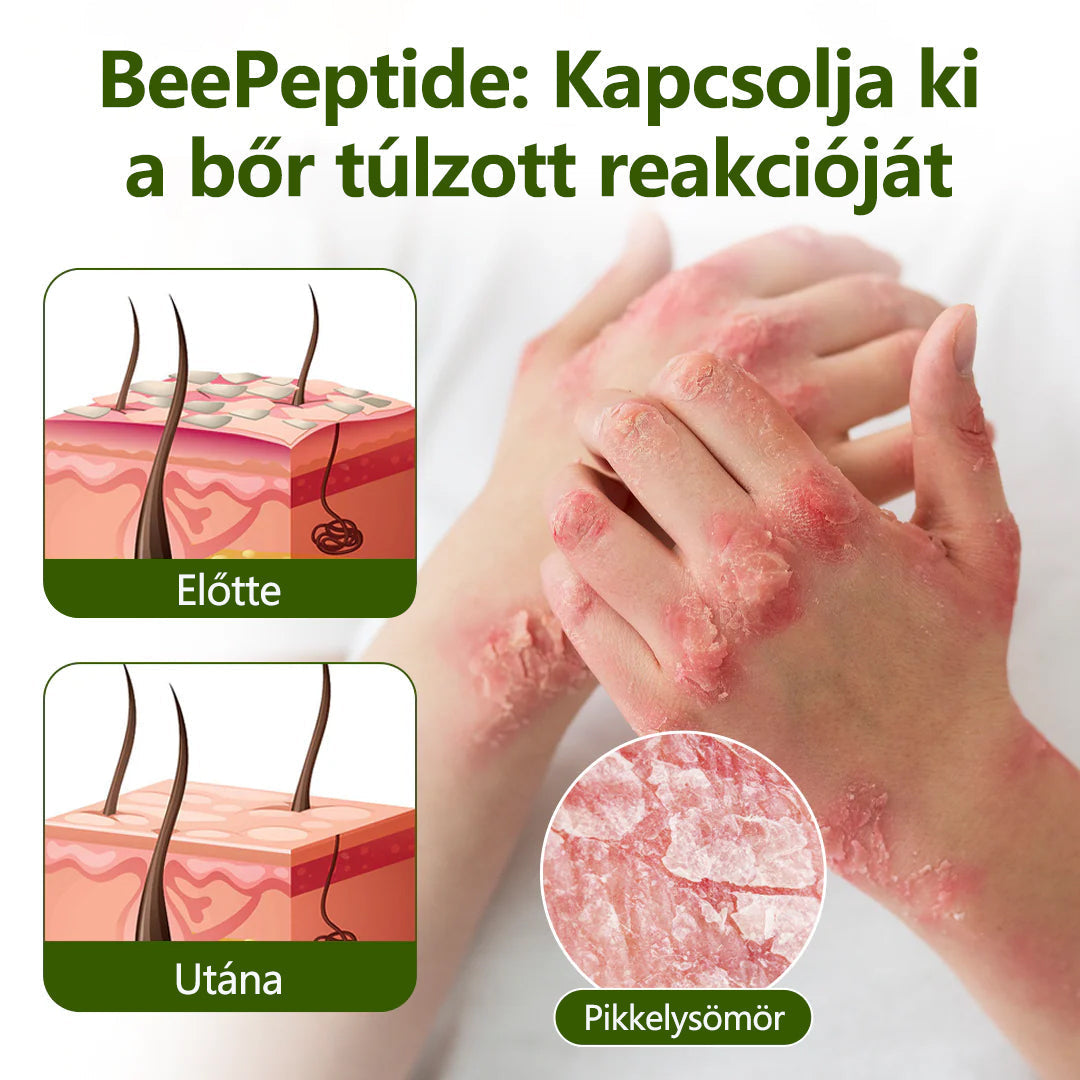 Tivora®✨ MéhPeptid GyökérPuhító Kétirányú Megkönnyebbülés Krém