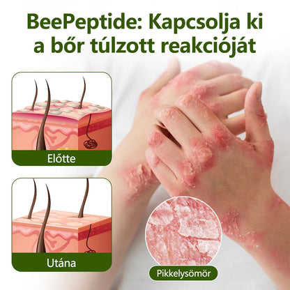 Tivora®✨ MéhPeptid GyökérPuhító Kétirányú Megkönnyebbülés Krém