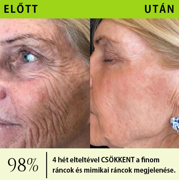 ✨ Vosxu™ Botox & Vita-A Retinol Shot ráncfelvarró szérum ✨ – 💉 Mikro-tűk | 💪 Botox-szerű peptidek | 🌿 Retinol | ⚡ Látható eredmények már 3 nap alatt 🌸