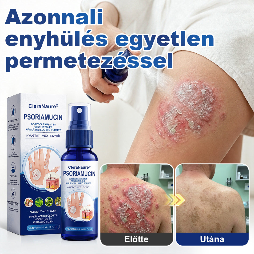 CleraNaure® PsoriaMucin Dörzsölésmentes Viszketés- és Pikkelyenyhítő Permet🎁