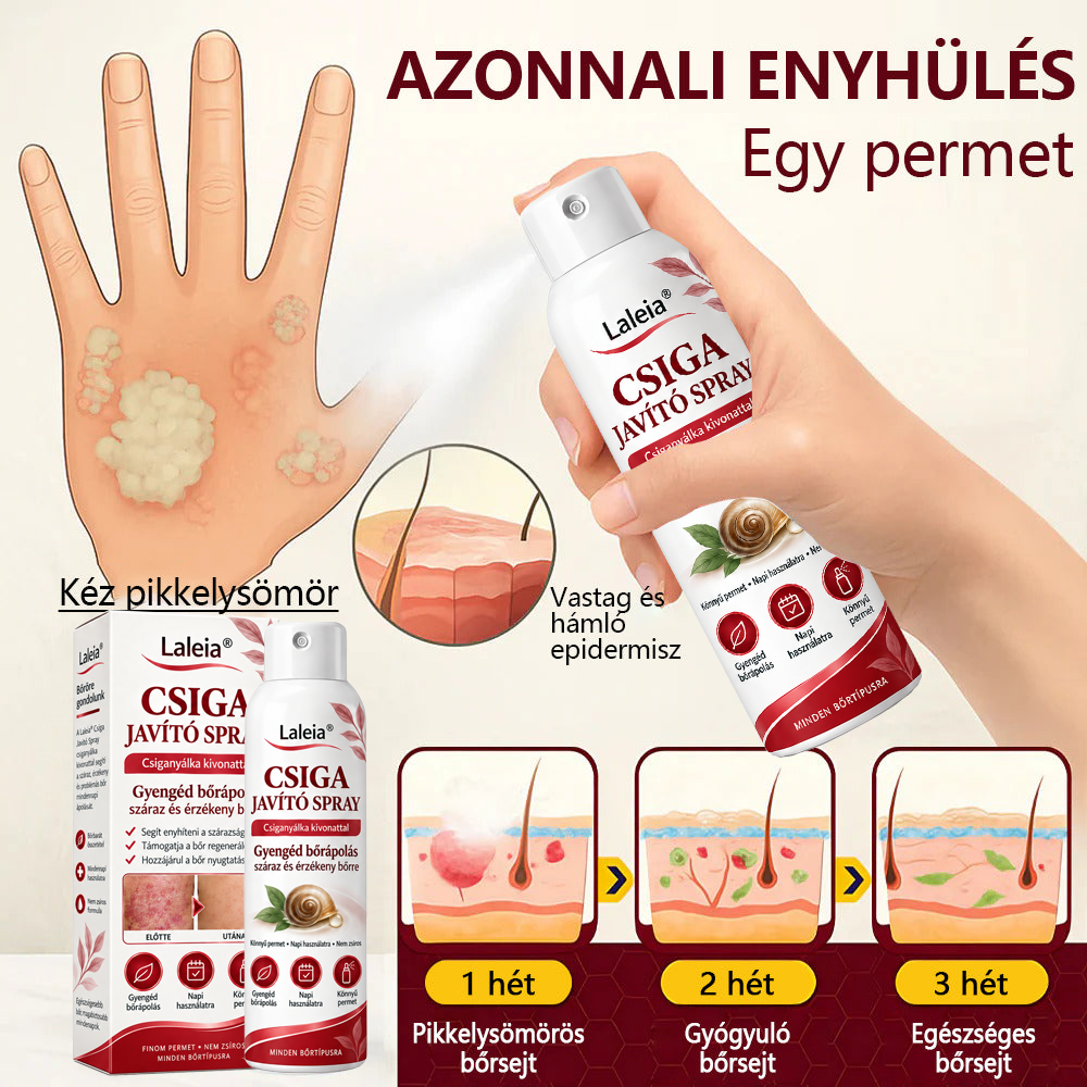 Laleia® Csiganyálka Spray száraz, viszkető és hámló bőr mindennapi ápolására🎁