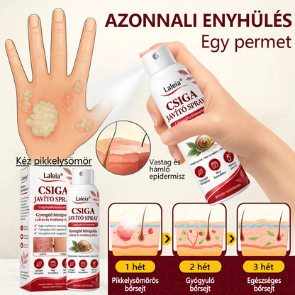 Laleia® Csiganyálka Spray száraz, viszkető és hámló bőr mindennapi ápolására🎁