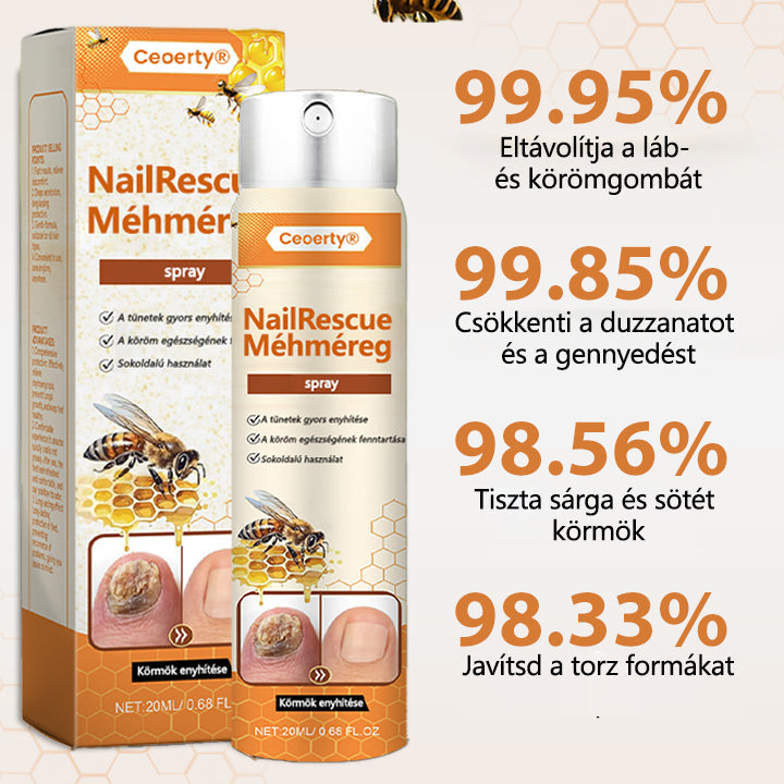 2026🎁 Korlátozott idejű akció 70% kedvezménnyel ️️⏳ Ceoerty® körömgomba spray méhméreggel 💥 2 hét alatt megoldja az összes körömproblémát