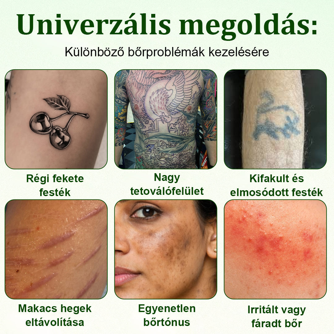 🛡️CleraNaure® Tiszta Algás Festékeltávolító Támogató Spray 🌿 — Búcsúzz el a régi tetoválópigmentektől 💚, Halványítsd a makacs festéket ✨, Helyreállítja és kisimítja a kezelt bőrt 💧, Lézermentes ✅, Próbáld ki most! 🔥