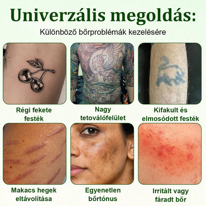 🛡️CleraNaure® Tiszta Algás Festékeltávolító Támogató Spray 🌿 — Búcsúzz el a régi tetoválópigmentektől 💚, Halványítsd a makacs festéket ✨, Helyreállítja és kisimítja a kezelt bőrt 💧, Lézermentes ✅, Próbáld ki most! 🔥