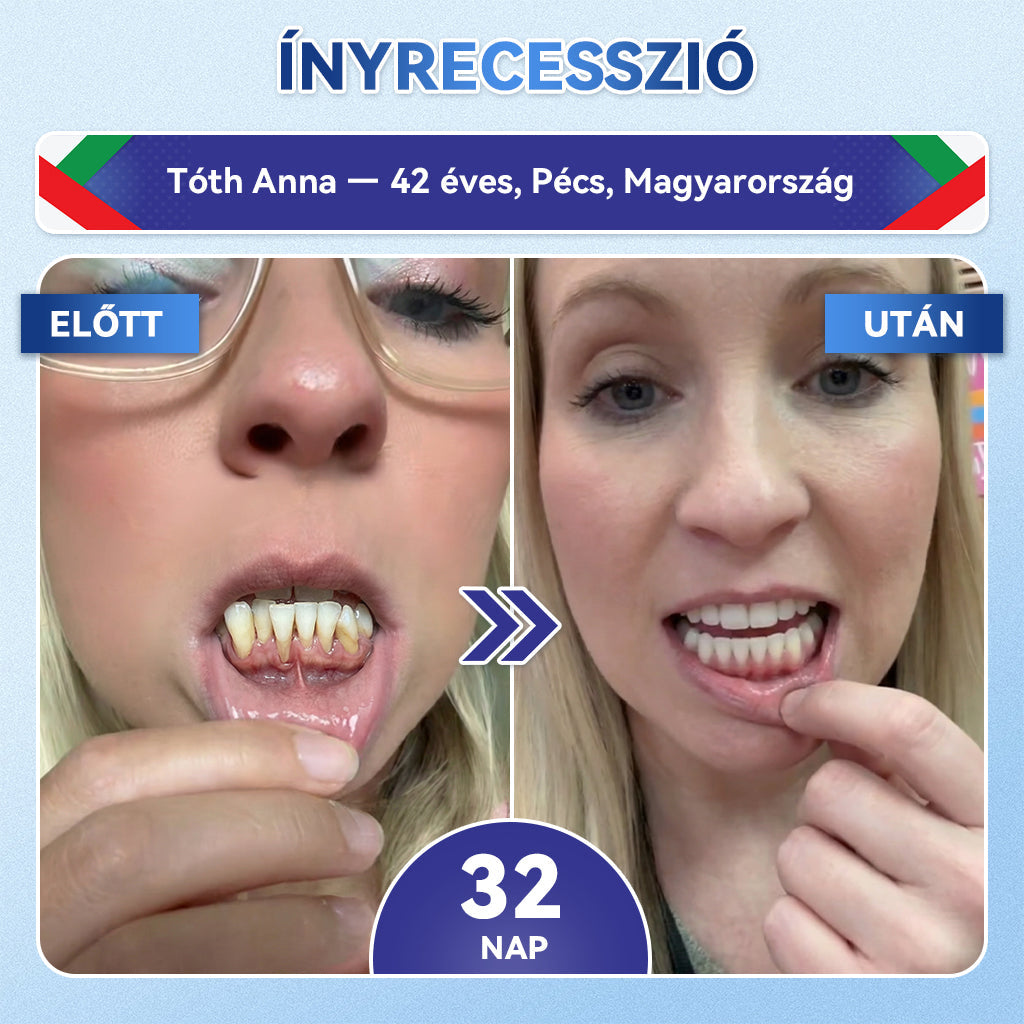 🦷🦷𝐆𝐥𝐢𝐦𝐦𝐞𝐫𝐥𝐲® Tideglusib Fog & íny Javító mikrotűs tapasz | Fejlett őssejt-aktiváló fogcsíkok (újjáépíti a fogzománcot és a dentint • erősíti az ínyt • megszünteti a fogkövet és a szagokat • megállítja a fogérzékenységet)) 3.0