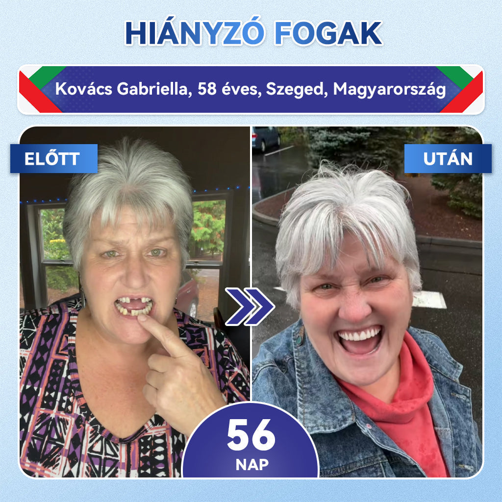 🦷🦷𝐆𝐥𝐢𝐦𝐦𝐞𝐫𝐥𝐲® Tideglusib Fog & íny Javító mikrotűs tapasz | Fejlett őssejt-aktiváló fogcsíkok (újjáépíti a fogzománcot és a dentint • erősíti az ínyt • megszünteti a fogkövet és a szagokat • megállítja a fogérzékenységet)) 3.0
