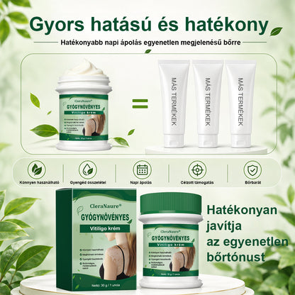 💎CleraNaure® Növényi Vitiligo Krém