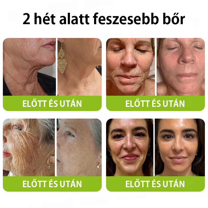 ✨ Vosxu™ Botox & Vita-A Retinol Shot ráncfelvarró szérum ✨ – 💉 Mikro-tűk | 💪 Botox-szerű peptidek | 🌿 Retinol | ⚡ Látható eredmények már 3 nap alatt 🌸