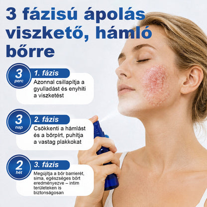 CleraNaure® PsoriaMucin Dörzsölésmentes Viszketés- és Pikkelyenyhítő Permet🎁