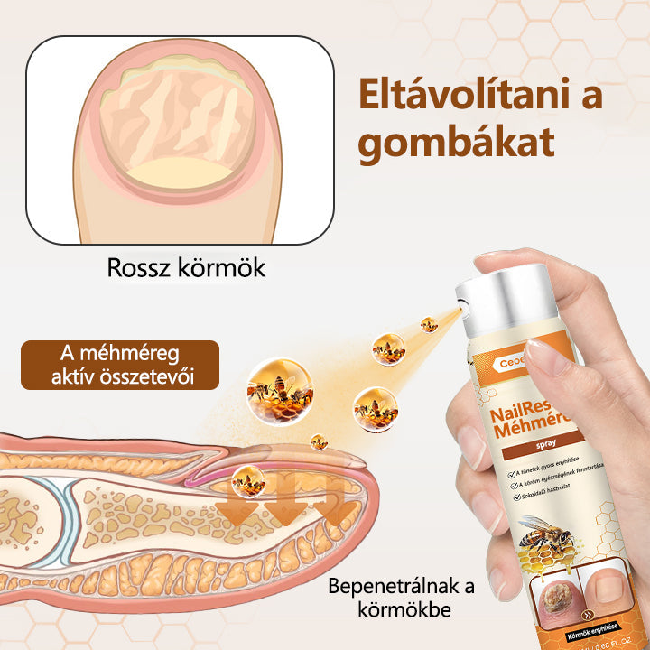 2026🎁 Korlátozott idejű akció 70% kedvezménnyel ️️⏳ Ceoerty® körömgomba spray méhméreggel 💥 2 hét alatt megoldja az összes körömproblémát