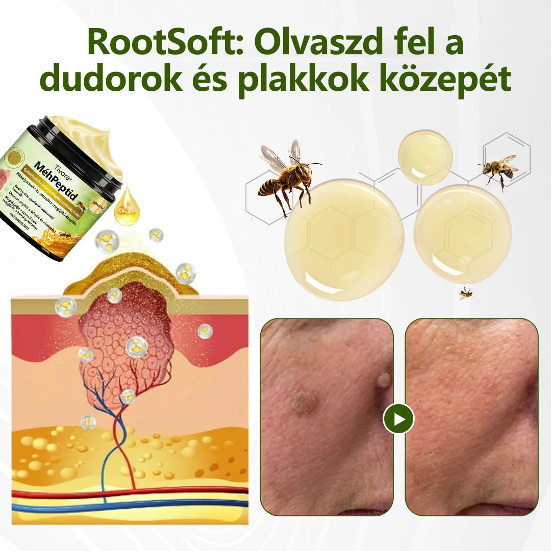 Tivora®✨ MéhPeptid GyökérPuhító Kétirányú Megkönnyebbülés Krém