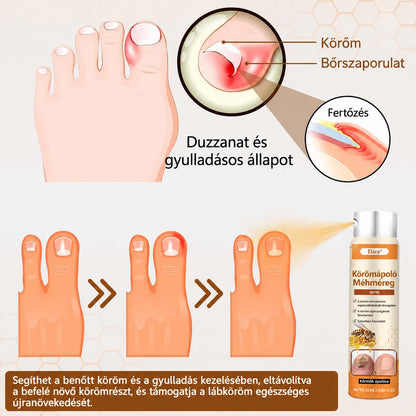 🌿Elara® NailRescue méhméreg spray📦