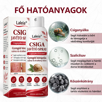 Laleia® Csiganyálka Spray száraz, viszkető és hámló bőr mindennapi ápolására🎁