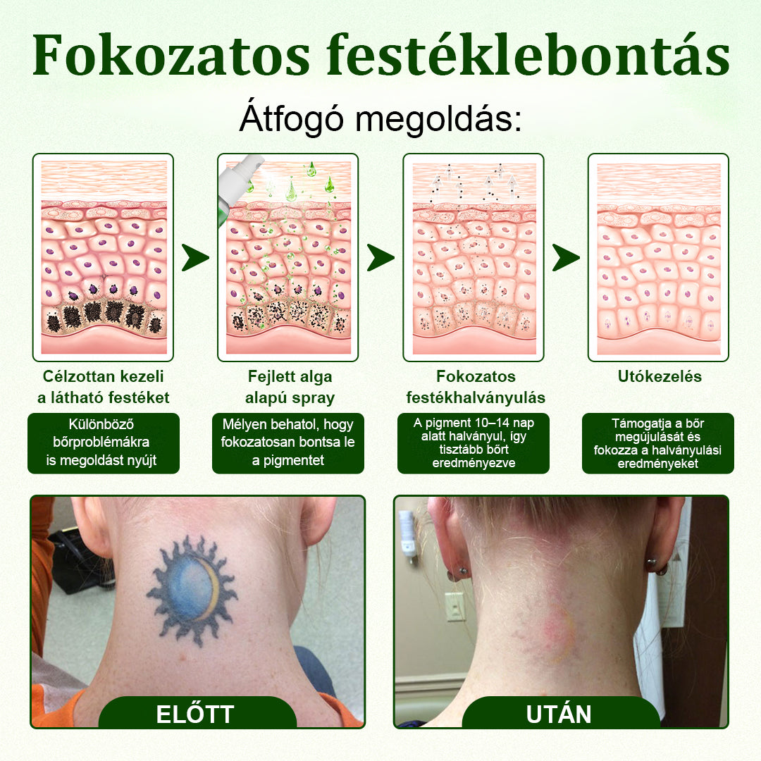 🛡️CleraNaure® Tiszta Algás Festékeltávolító Támogató Spray 🌿 — Búcsúzz el a régi tetoválópigmentektől 💚, Halványítsd a makacs festéket ✨, Helyreállítja és kisimítja a kezelt bőrt 💧, Lézermentes ✅, Próbáld ki most! 🔥