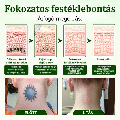 🛡️CleraNaure® Tiszta Algás Festékeltávolító Támogató Spray 🌿 — Búcsúzz el a régi tetoválópigmentektől 💚, Halványítsd a makacs festéket ✨, Helyreállítja és kisimítja a kezelt bőrt 💧, Lézermentes ✅, Próbáld ki most! 🔥