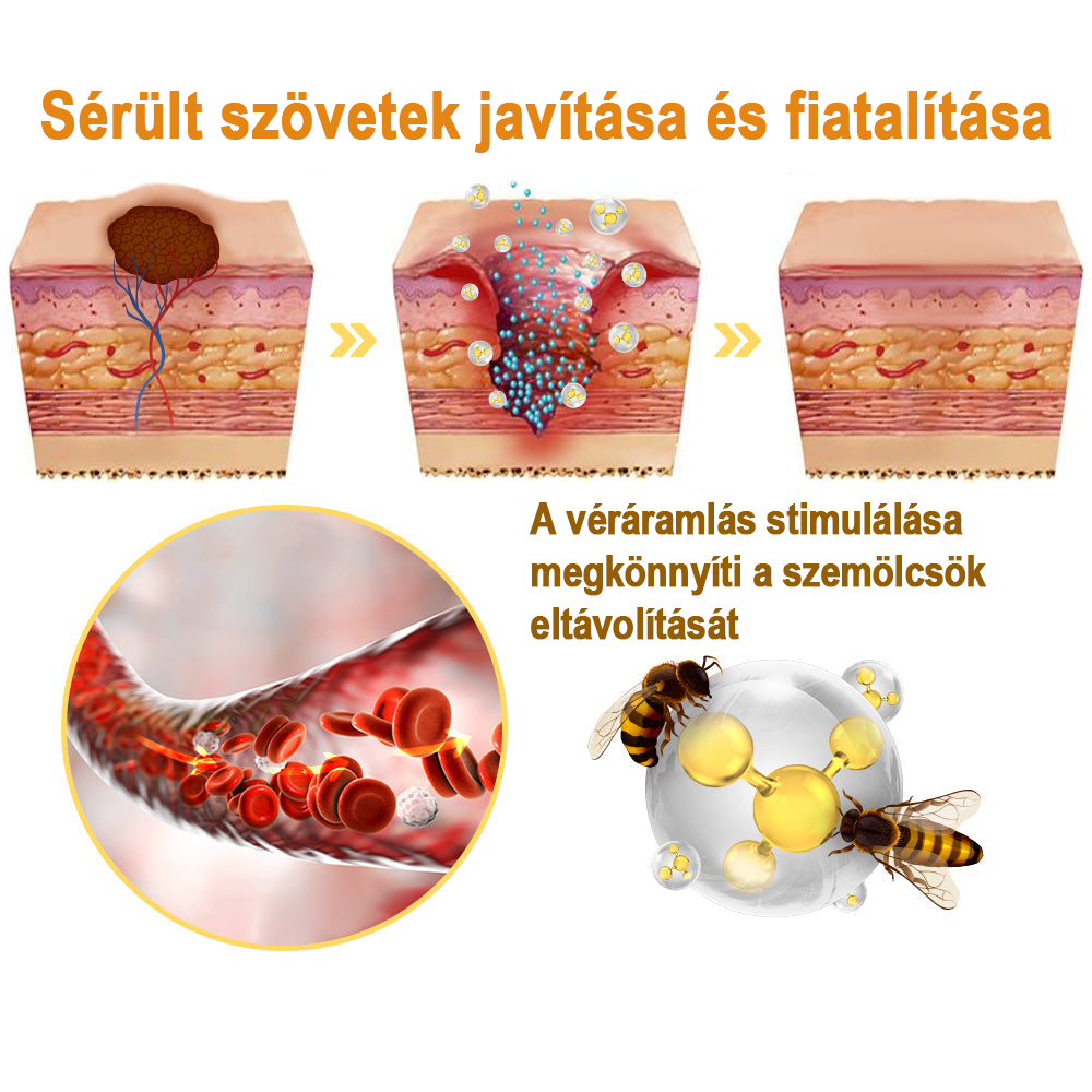 🐝🐝Méhméreg szemölcs és övsömör eltávolító spray (👨‍⚕AAD Ajánlott) 🔥(🔥Last Day 80% Off)