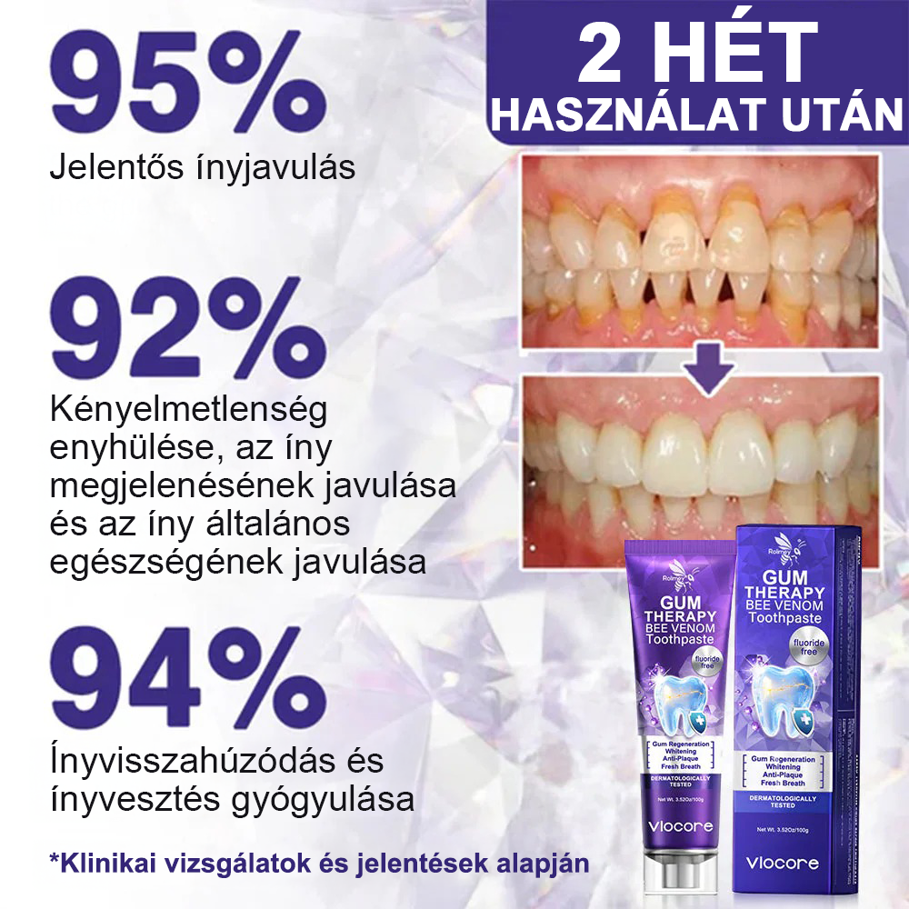 🌟Rolimey® VioCore Méhméreg Fogkezelő Fogkrém🩹