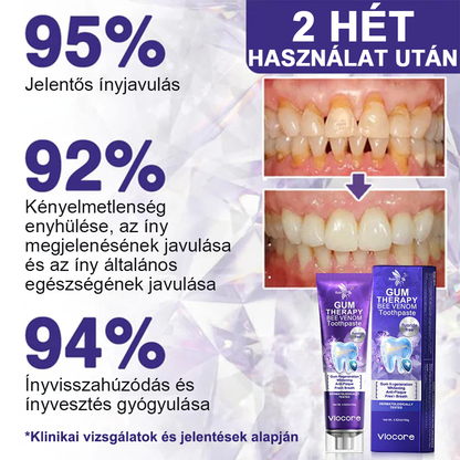 🌟Rolimey® VioCore Méhméreg Fogkezelő Fogkrém🎁