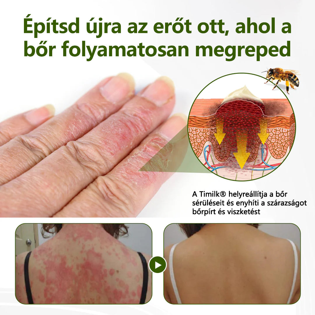 Tivora®✨ MéhPeptid GyökérPuhító Kétirányú Megkönnyebbülés Krém