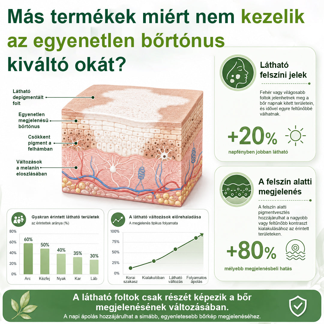 💎CleraNaure® Növényi Vitiligo Krém