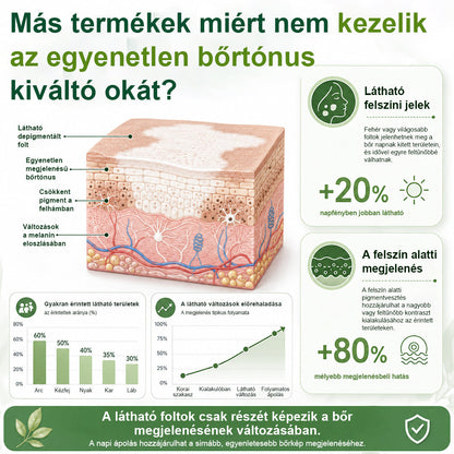 💎CleraNaure® Növényi Vitiligo Krém