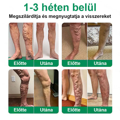 Twisma® VeinTarget – Fejlett mikro tapasz a visszerekre 🔥 96% klinikailag igazolt hatékonyság ⚡ Látható eredmények már 7–14 nap alatt 🌿 Kíméletes támogatás a könnyebb és felszabadult lábakért  🦵