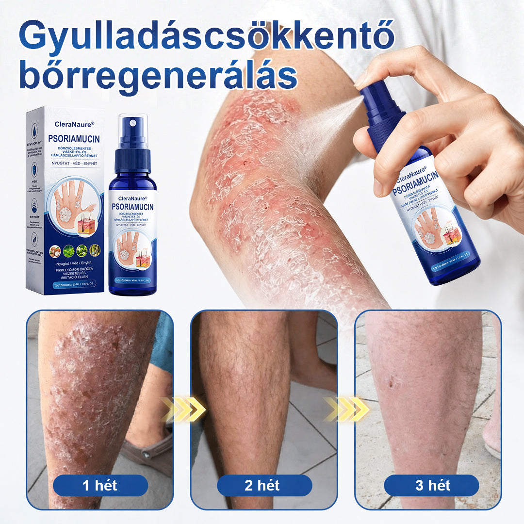 CleraNaure® PsoriaMucin Dörzsölésmentes Viszketés- és Pikkelyenyhítő Permet🎁