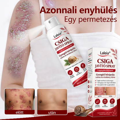 Laleia® Csiganyálka Spray száraz, viszkető és hámló bőr mindennapi ápolására🎁