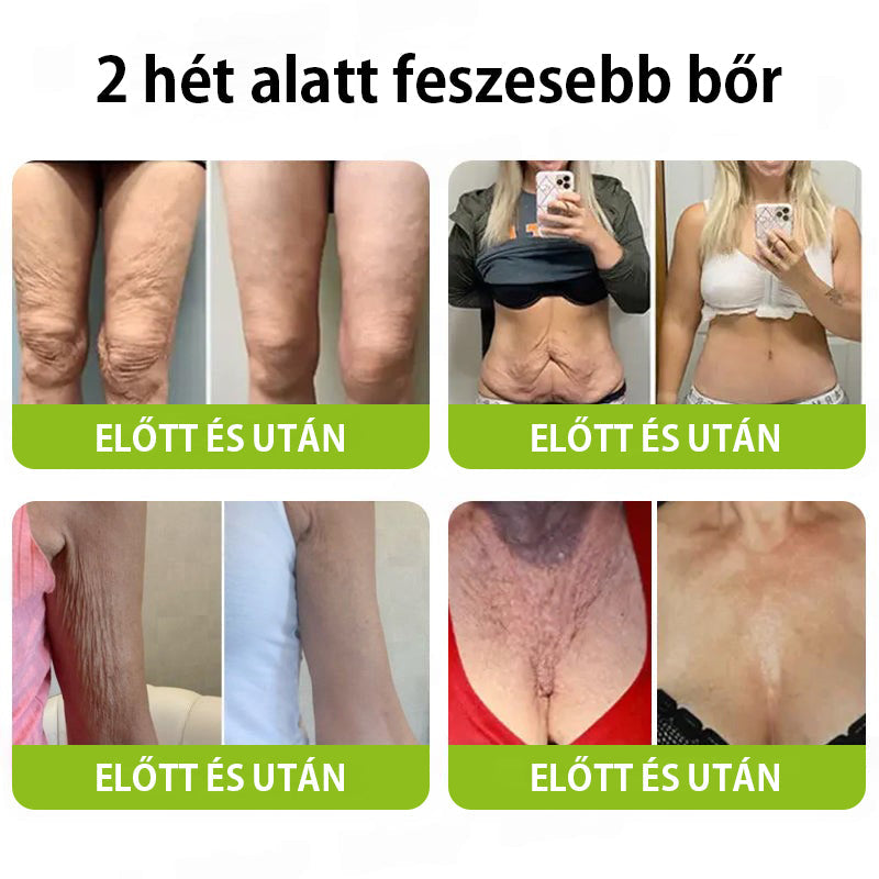 ✨ Vosxu™ Botox & Vita-A Retinol Shot ráncfelvarró szérum ✨ – 💉 Mikro-tűk | 💪 Botox-szerű peptidek | 🌿 Retinol | ⚡ Látható eredmények már 3 nap alatt 🌸