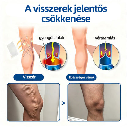 🇭🇺Yutuof® 👩‍⚕️VeinTarget mikrotűs tapasz⚡☑️Azonnali enyhülés hosszú távú eredmények-🔥